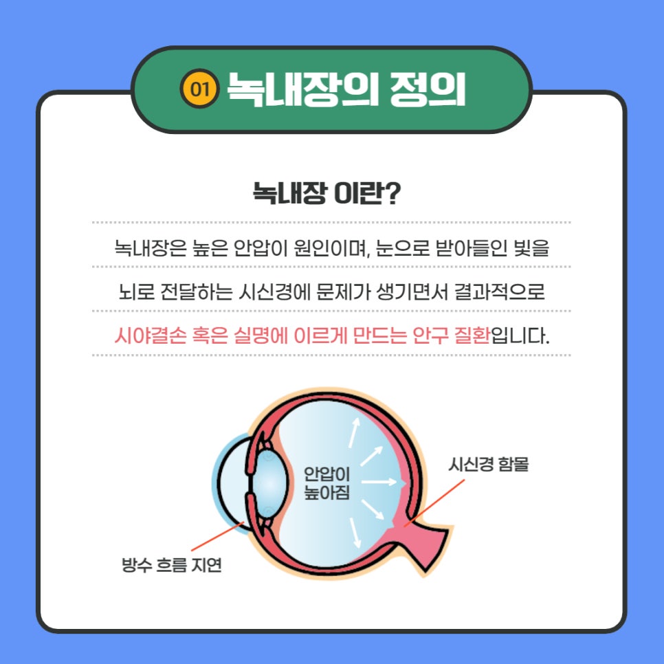 [건강정보통통] - 백내장, 녹내장 바로 알기 게시물의 첨부 이미지 1